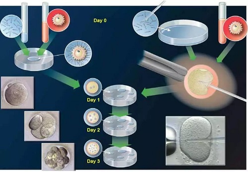 冷冻胚胎后在美国做试管移植的条件